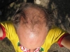 Grand Teton Nat Pk, WY, USA - on left, inch-long gash in my head from a snapped-off branch after 4 stitches and earlier fear that bears would pounce on me as I bled all over the campsite (Photoshop used to remove hair...;) )